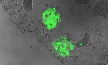 图1:绿色荧光显示整合进入肾小球的SOX9⁺肾前体细胞(临床前研究数据) 图1:绿色荧光显示整合进入肾小球的SOX9⁺肾前体细胞(临床前研究数据)